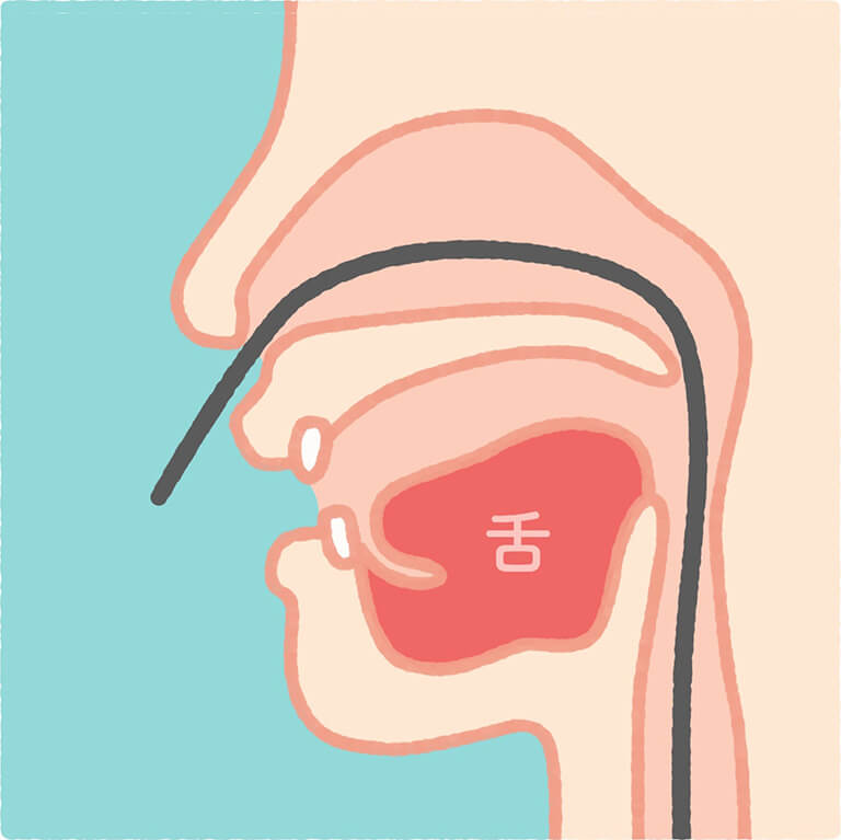 経鼻内視鏡（鼻から挿入）