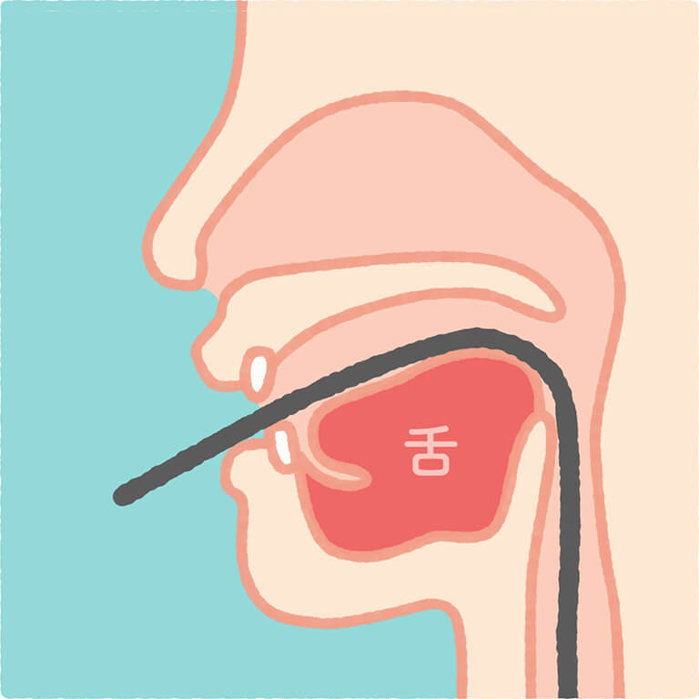 経口内視鏡（口から挿入）